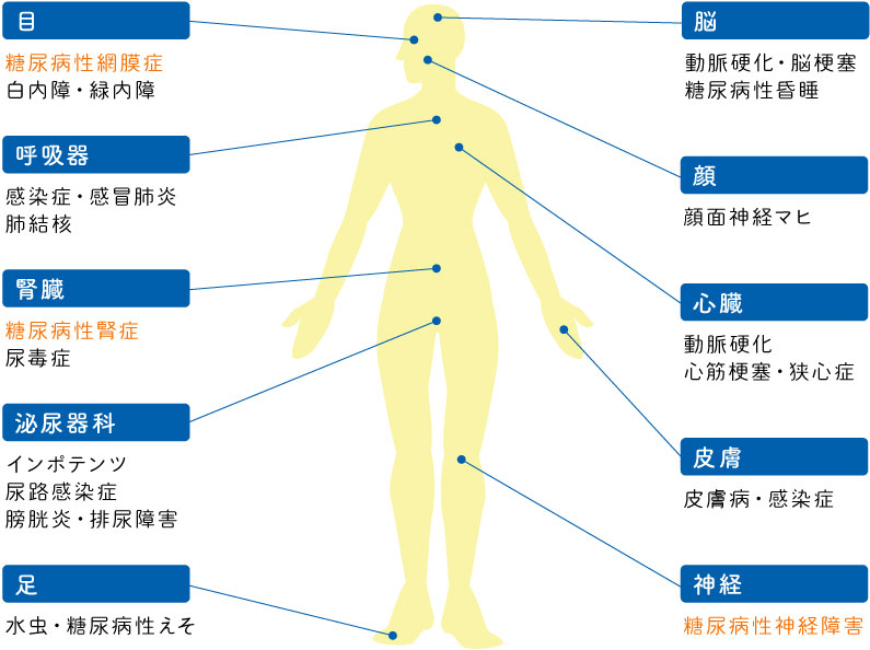 目(糖尿病性網膜症・白内障・緑内障)呼吸器(感染症・感冒肺炎・肺結核)腎臓(糖尿病性腎症・尿毒症)泌尿器科(インポテンツ・尿路感染症・膀胱炎・排尿障害)足(水虫・糖尿病性えそ)脳(動脈硬化・脳梗塞・糖尿病性昏睡)顔(顔面神経マヒ)心臓(動脈硬化・心筋梗塞・狭心症)皮膚(皮膚病・感染症)神経(糖尿病性神経障害)